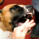 Dog Bite Injury
